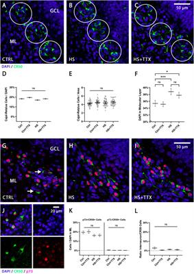 <mark class="highlighted">Tetrodotoxin</mark> prevents heat-shock induced granule cell dispersion in hippocampal slice cultures